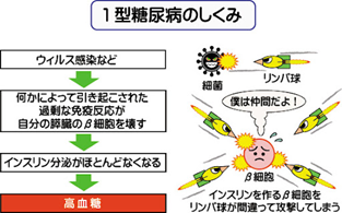 1型糖尿病と2型糖尿病の違い